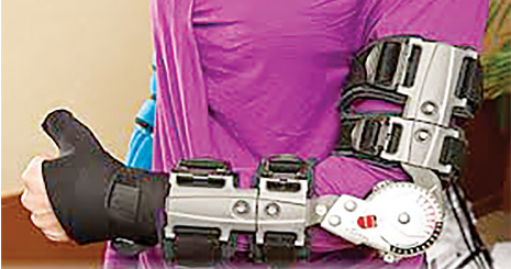 Stainless Steel – A Family of Medical Device Materials